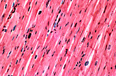 Light micrograph of cardiac muscle