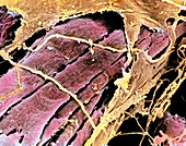 Coloured SEM of smooth muscle in human oviduct