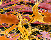 Coloured SEM of smooth muscle in human oviduct