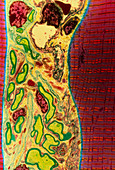 Coloured TEM of skeletal muscle and nerve fibres