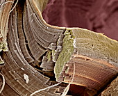 Muscle fibre,SEM