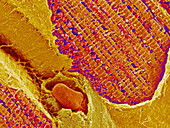 Cardiac muscle