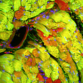 Heart muscle,confocal light micrograph