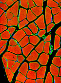 Skeletal muscle fibres,light micrograph