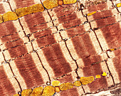 Cardiac muscle,TEM