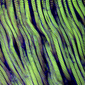 Muscle,fibres,light micrograph