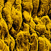 SEM of synovial membrane of knee joint (normal)