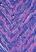 LM of fibrocartilage