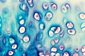 Hyaline cartilage,light micrograph