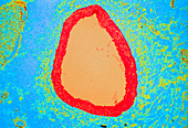 Coloured LM of a section through a coronary artery