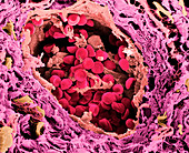 Coloured SEM of a blood vessel in the skin