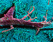Coloured SEM of a blood vessel in the spinal cord