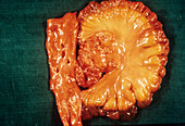 Aorta,small intestine and mesentery