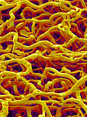 Blood vessels from the colon,SEM