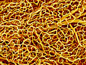 Blood vessels from the pancreas,SEM