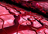 Blood vessel dilation,computer artwork