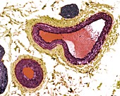 Blood vessels,light micrograph