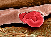 Ruptured capillary,SEM