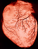 Heart with arteries