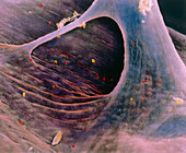 False-colour SEM of endocardium of human heart