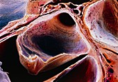 Coloured SEM of the aortic valve