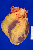 Gross specimen of a healthy human heart