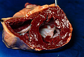 Section human heart to show ventricles and valves