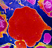 Colour TEM of a reticulocyte cell in bone marrow