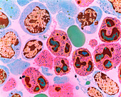 TEM of section through bone marrow cells