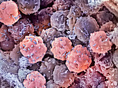 Foetal blood stem cells,SEM