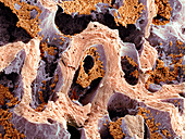 Bone marrow,SEM