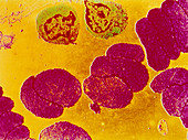 TEM of human blood showing red & white blood cells