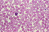 Human blood cells showing numerous red cells