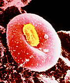 Coloured SEM of blood platelet & red blood cell