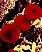 Coloured SEM of 3 human red blood cells