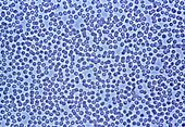 Light micrograph of a group of red blood cells