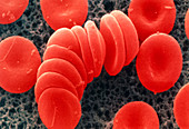 Coloured SEM of red blood cells,rouleau formation