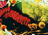 Colour SEM of red blood cells in rouleau formation