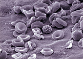 SEM of blood cells