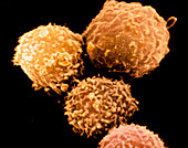 SEM of B-lymphocytes white blood cells