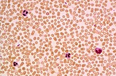 LM of a field of red and white blood cells