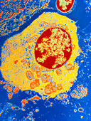 Coloured TEM of plasma cell from a lymph node