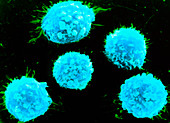 Coloured SEM of B-lymphocyte white blood cells