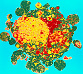 Coloured TEM of apoptosis in a white blood cell