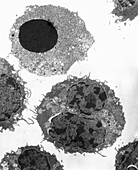 TEM of a myeloid white blood cell during apoptosis