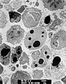 TEM of myeloid white blood cells during apoptosis