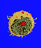 T-lymphocyte,TEM
