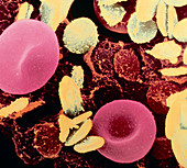 Coloured SEM of blood platelets & red blood cells