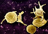 Activated platelets,SEM