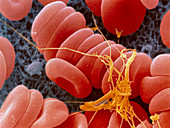 Coloured SEM of an early blood clot forming